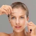 Chemical peelingproduct picture