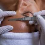 Dermaplaningproduct picture