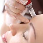 Microneedlingproduct picture