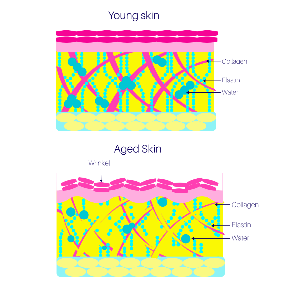 fine lines and wrinkels
