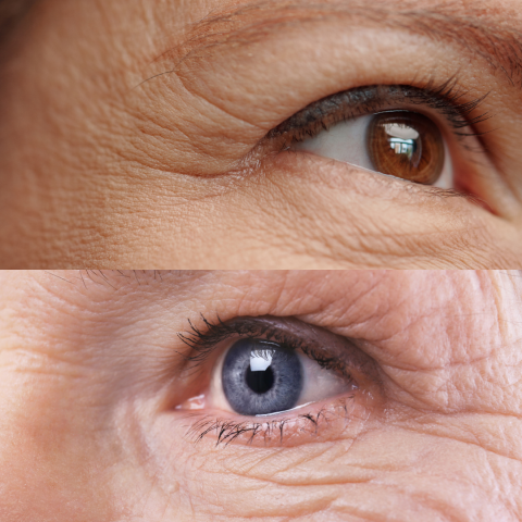 fine lines vs wrinkesl