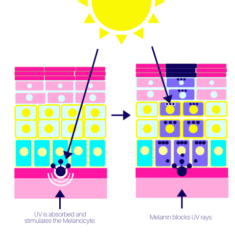 sun and hyperpigmentation