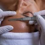 Dermaplaningproduct picture