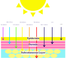 Sun Damage